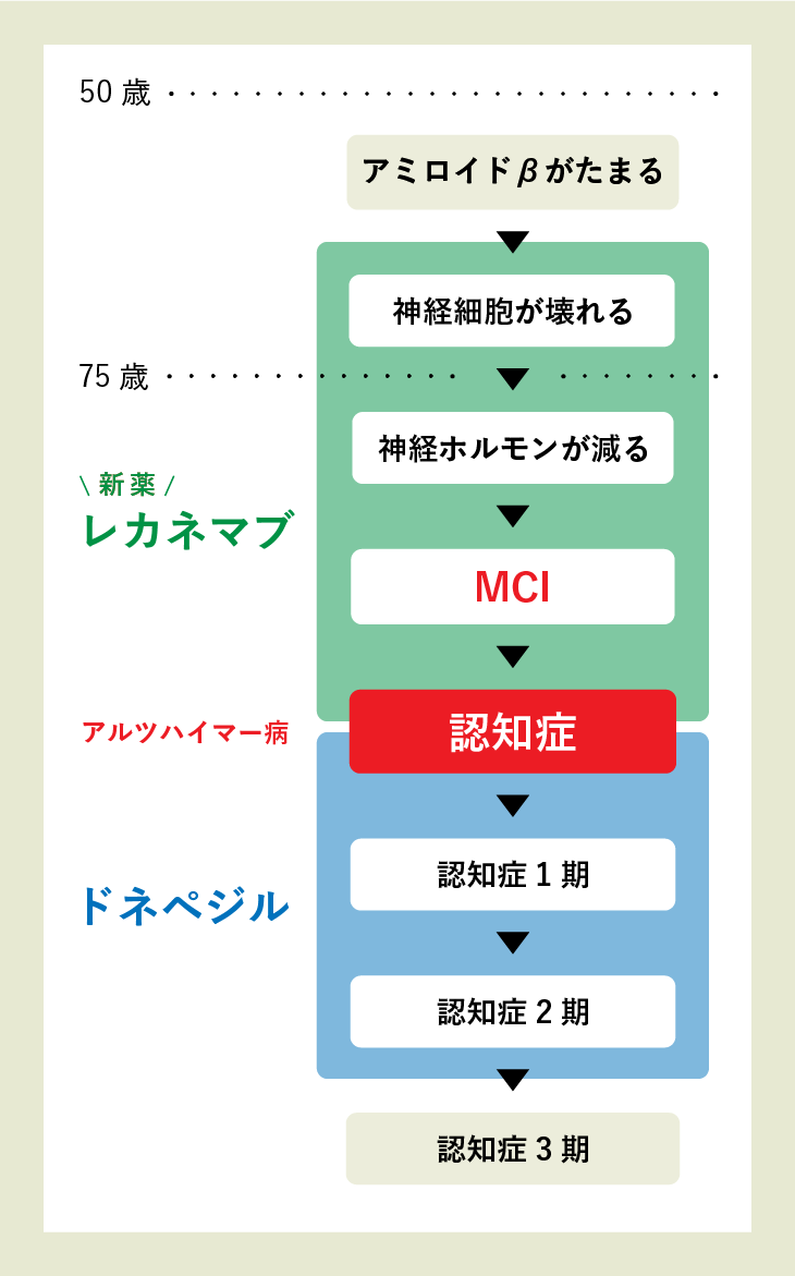 アミロイドβがたまる→【(新薬)レカネマブ】神経細胞が壊れる→神経ホルモンが減る→MCI→認知症→【ドネペジル】認知症1期→認知症2期→認知症3期